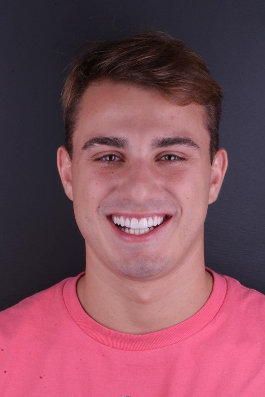 Paciente real do Instituto Breno Rodrigues sorrindo
